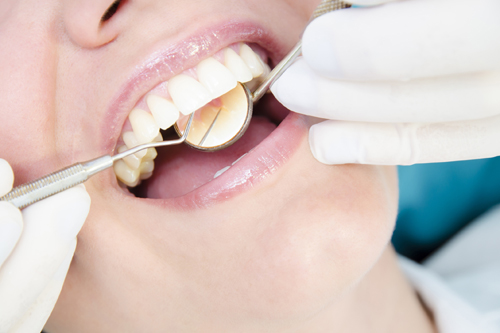 מדי שנה נערכות בישראל עשרות אלפי השתלות שיניים עם אחוזי הצלחה של עד כ-95%.